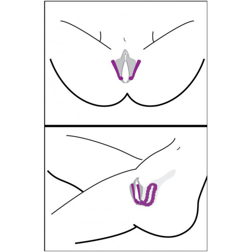 Oral Enhancing Hands Free Labia Spreader